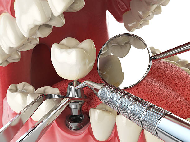 Best Broken Tooth Emergency  in Harriman, NY
